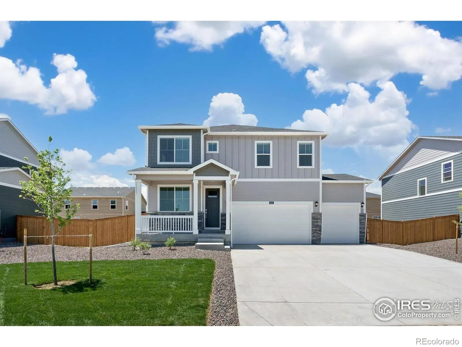 Vantage