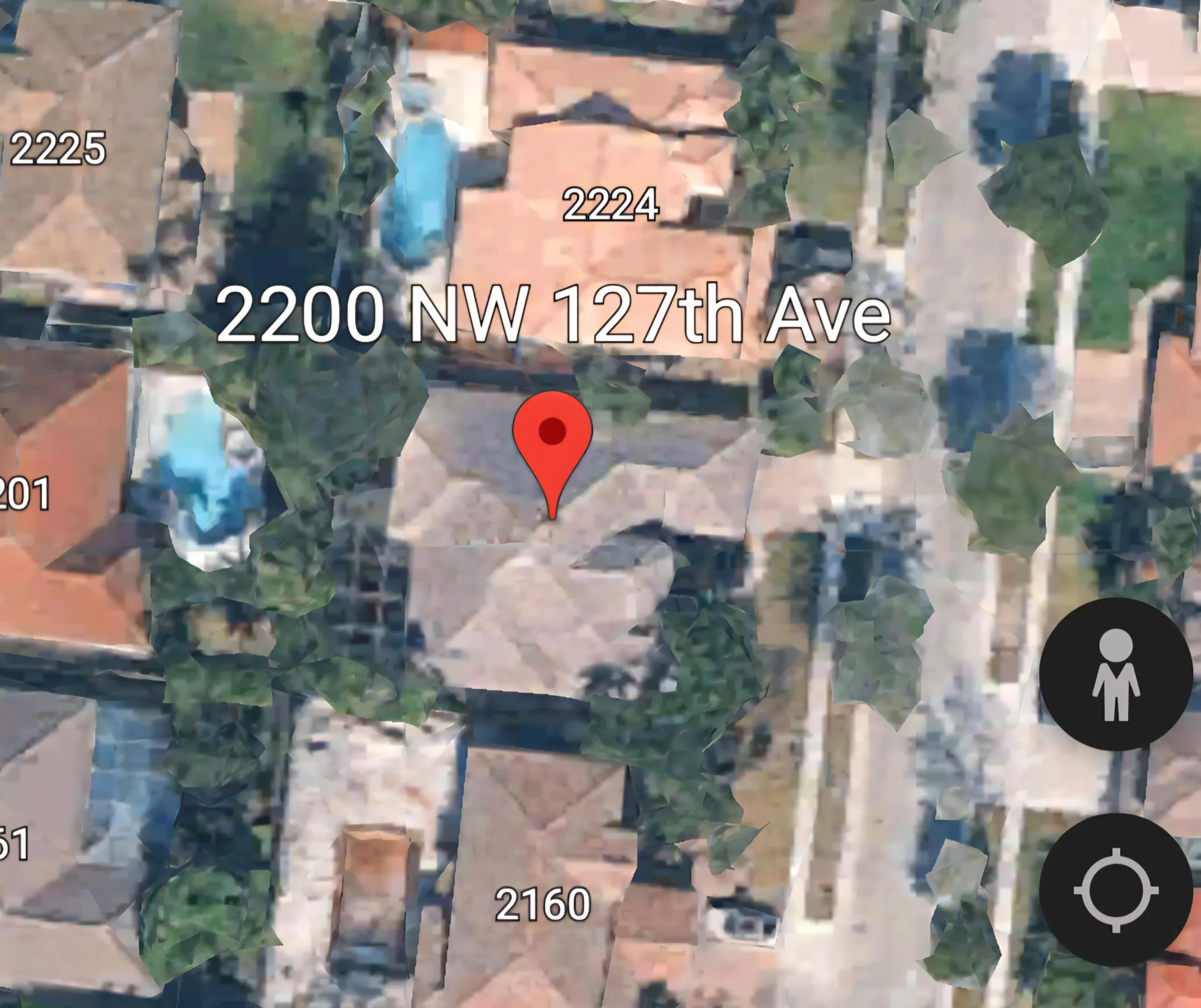 1000137335