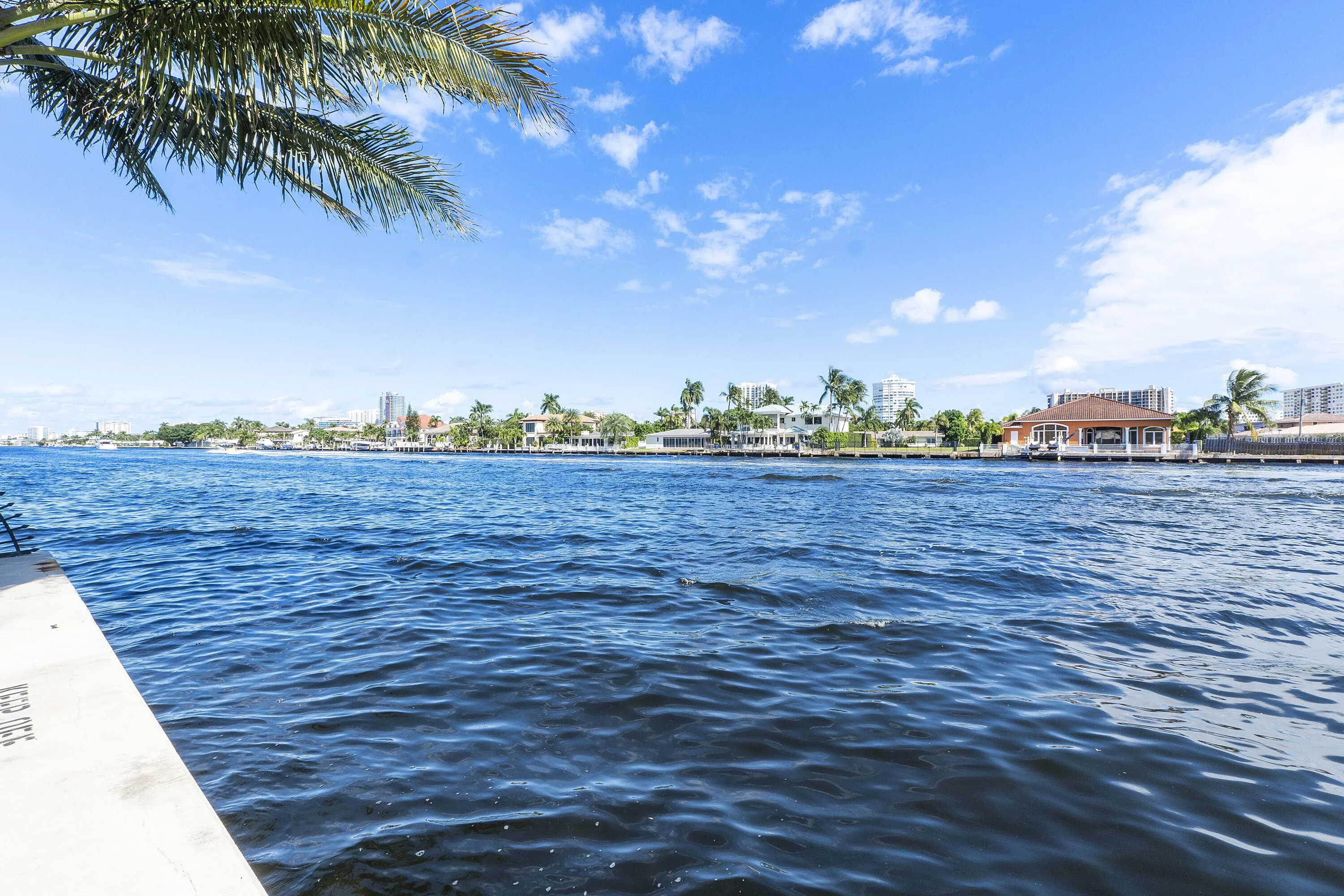 Intracostal
