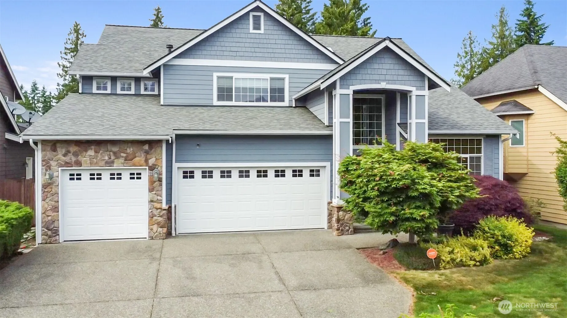 Property photo for 931 196th Place Sw, Lynnwood
