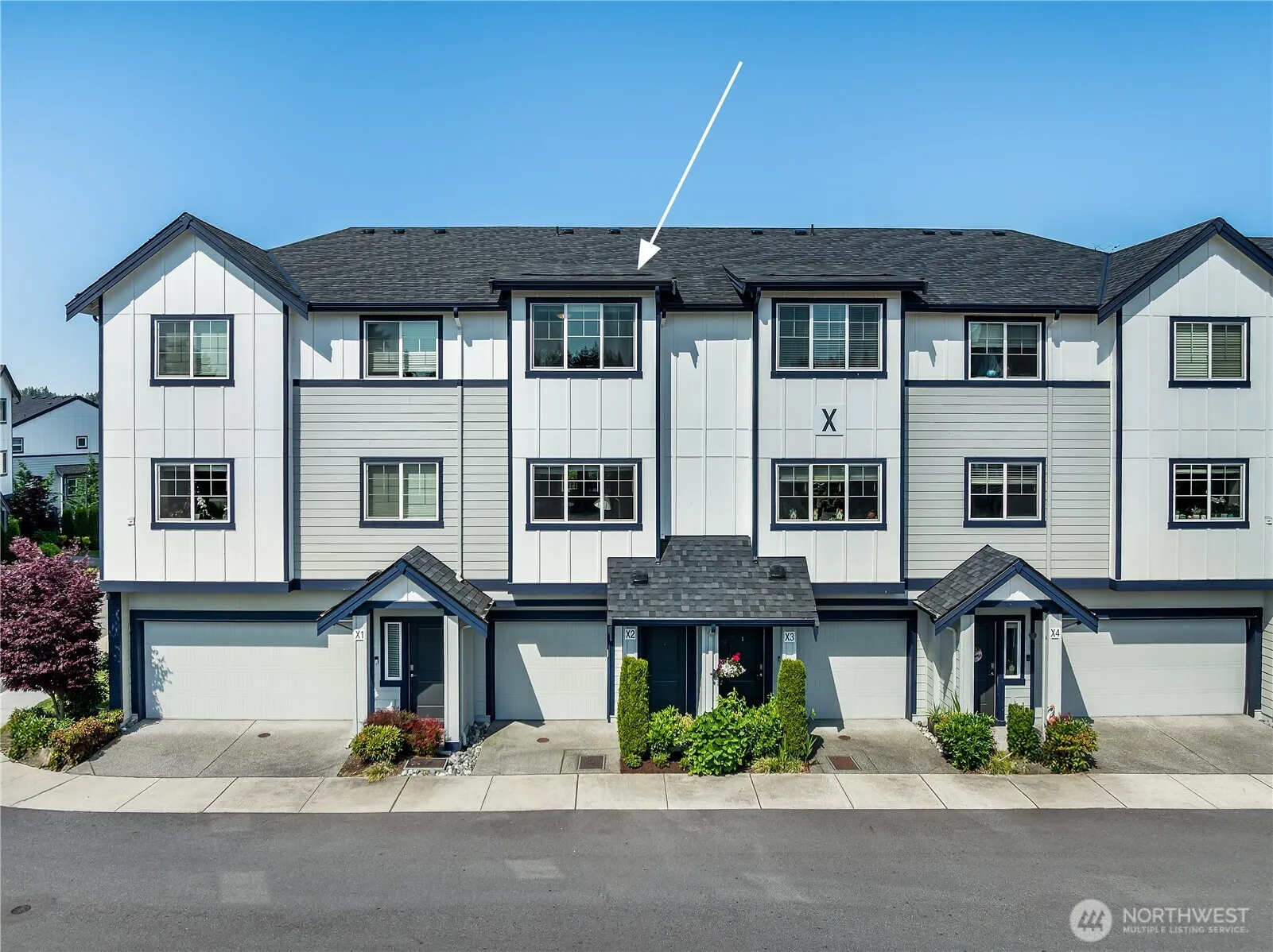 Property photo for 1621 Seattle Hill Road #x2, Bothell