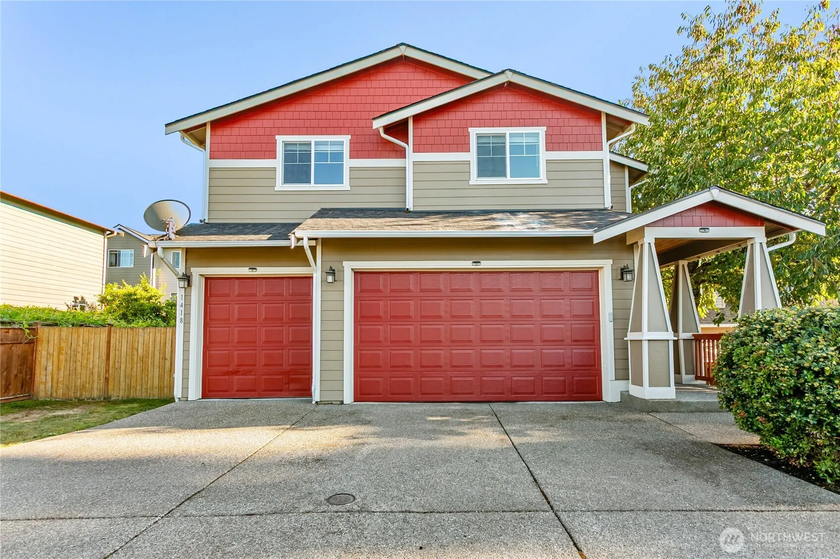 Property photo for 1418 E 68th Street Ct, Tacoma