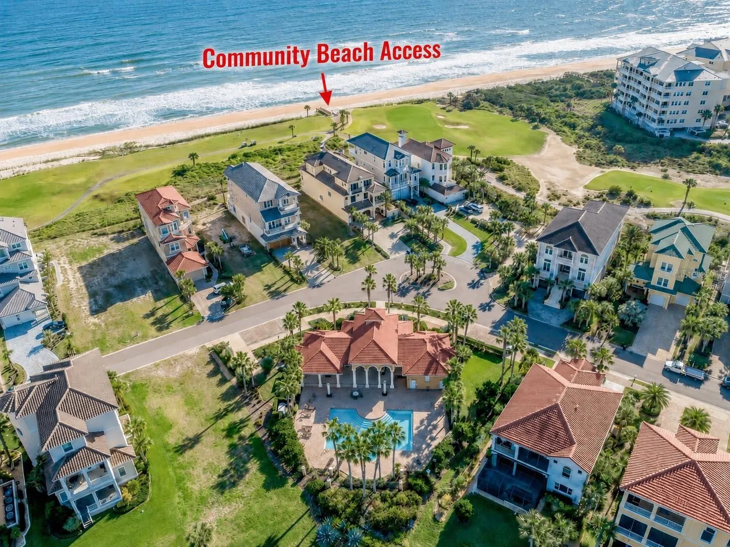 Community Beach walk over