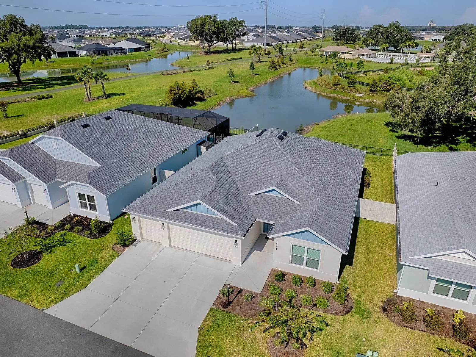 Right Side view of the house and the pond in the backyard