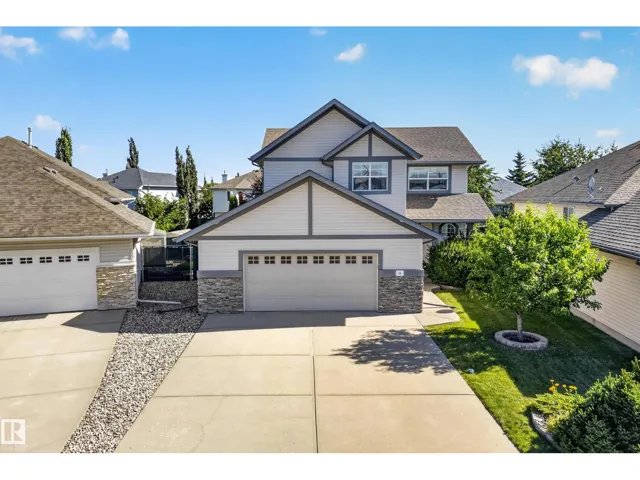 58 CARSON DR, Sherwood Park, Alberta T8H2K3