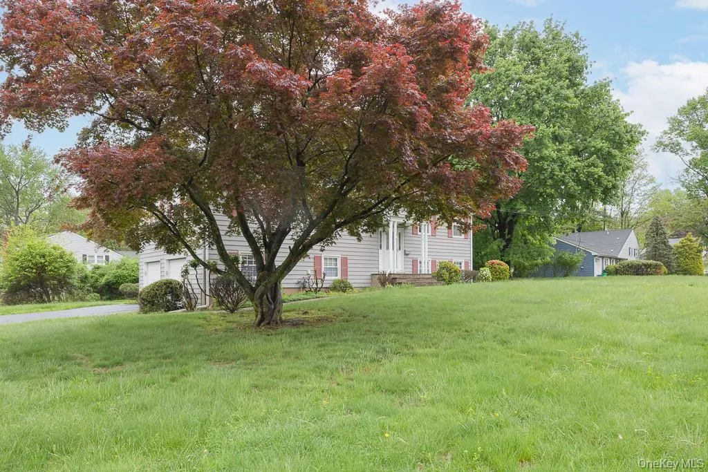 View of green lawn with a garage View of green lawn with a garage