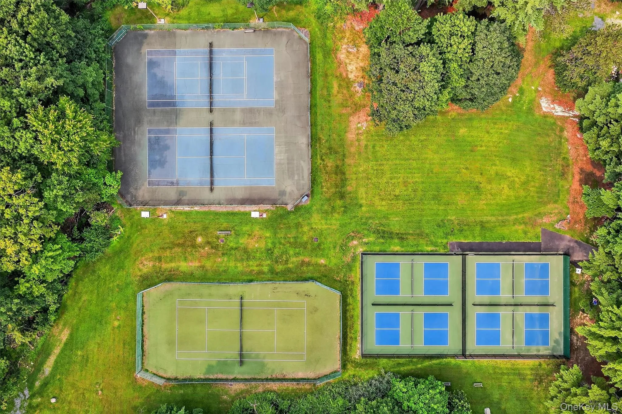 Pickleball or tennis. Take your pick in the park. Pickleball or tennis. Take your pick in the park.