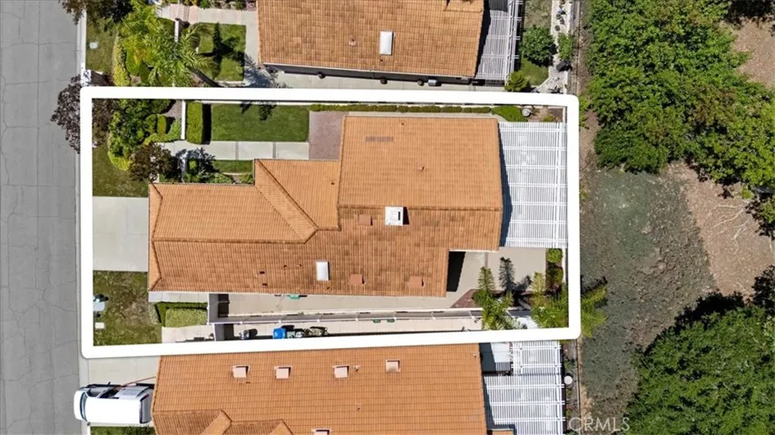 Overhead